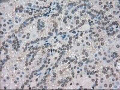 Immunohistochemistry-Paraffin: MIG2/Kindlin-2 Antibody (OTI9E4) [NBP1-47745]