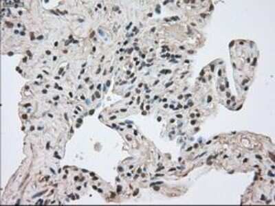 Immunohistochemistry-Paraffin: MIG2/Kindlin-2 Antibody (OTI9E4) [NBP1-47745]