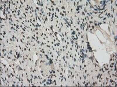 Immunohistochemistry-Paraffin: MIG2/Kindlin-2 Antibody (OTI9E4) [NBP1-47745]