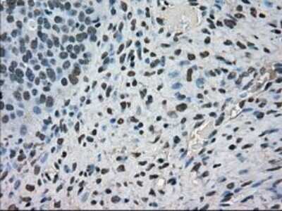 Immunohistochemistry-Paraffin: MIG2/Kindlin-2 Antibody (OTI9E4) [NBP1-47745]