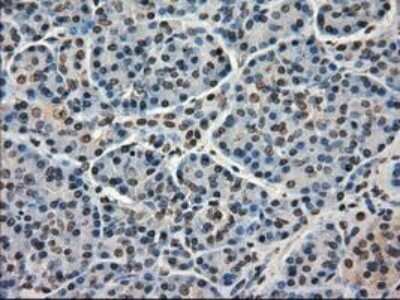 Immunohistochemistry-Paraffin: MIG2/Kindlin-2 Antibody (OTI9E4) [NBP1-47745]