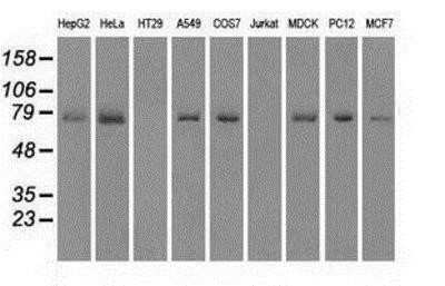 Western Blot: MIG2/Kindlin-2 Antibody (OTI9E4) [NBP1-47745]