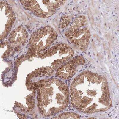 Immunohistochemistry-Paraffin: MINDY2 Antibody [NBP2-14724]