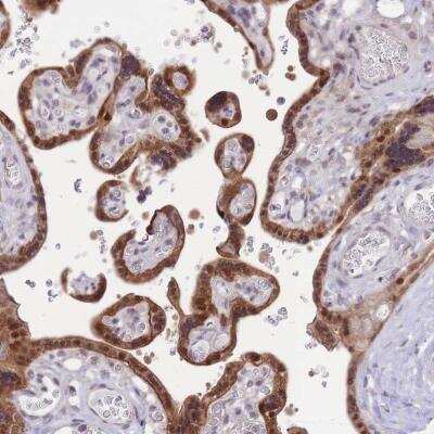 Immunohistochemistry-Paraffin: MINDY2 Antibody [NBP2-14724]