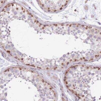 Immunohistochemistry-Paraffin: MINDY2 Antibody [NBP2-14724]