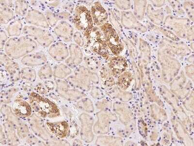 Immunohistochemistry: MINDY2 Antibody [NBP3-06279]