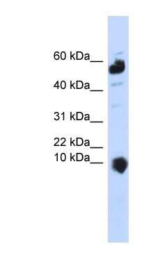 Western Blot: MINOS1 Antibody [NBP1-91587]