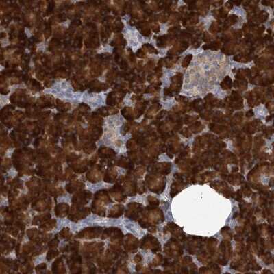 Immunohistochemistry-Paraffin: MINPP1 Antibody [NBP1-82644]