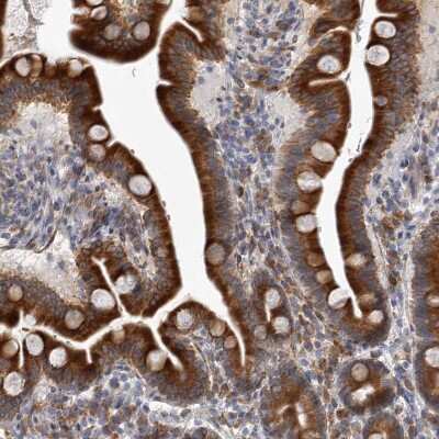 Immunohistochemistry-Paraffin: MINPP1 Antibody [NBP1-82644]
