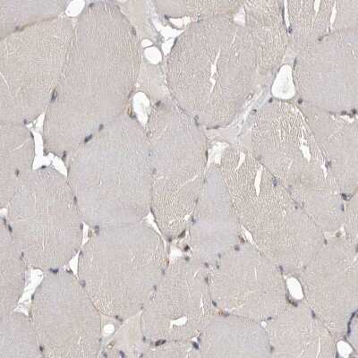Immunohistochemistry-Paraffin: MINPP1 Antibody [NBP1-82644]