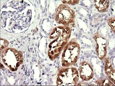 Immunohistochemistry: MINPP1 Antibody (OTI1B2) [NBP2-45845]