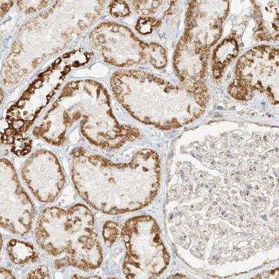 Immunohistochemistry: MIPEP Antibody [NBP1-82645]