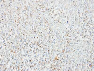 Immunohistochemistry-Paraffin: MIPEP Antibody [NBP1-32008]