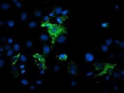 Immunocytochemistry/ Immunofluorescence: MIPEP Antibody (OTI5E7) - Azide and BSA Free [NBP2-72706]