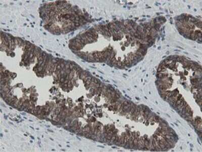 Immunohistochemistry: MIPEP Antibody (OTI5E7) [NBP2-45861]