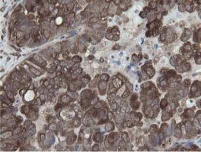 Immunohistochemistry: MIPEP Antibody (OTI5E7) [NBP2-45861]