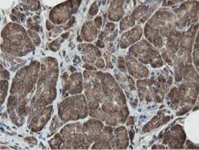 Immunohistochemistry: MIPEP Antibody (OTI5E7) [NBP2-45861]