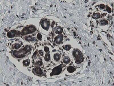 Immunohistochemistry: MIPEP Antibody (OTI5E7) [NBP2-45861]