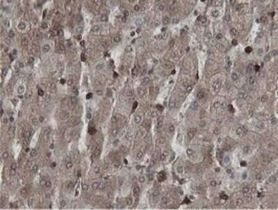 Immunohistochemistry: MIPEP Antibody (OTI5E7) [NBP2-45861]