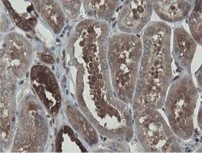 Immunohistochemistry: MIPEP Antibody (OTI5E7) [NBP2-45861]
