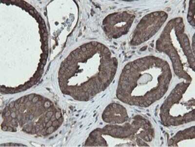 Immunohistochemistry: MIPEP Antibody (OTI5E7) [NBP2-45861]