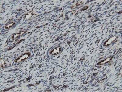 Immunohistochemistry: MIPEP Antibody (OTI5E7) [NBP2-45861]