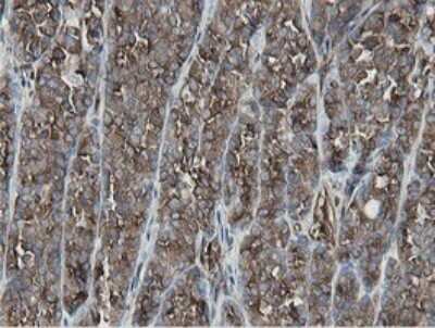 Immunohistochemistry: MIPEP Antibody (OTI5E7) [NBP2-45861]