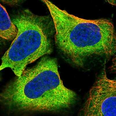 Immunocytochemistry/ Immunofluorescence: MIPOL1 Antibody [NBP2-55615]