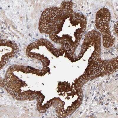 Immunohistochemistry-Paraffin: MIPOL1 Antibody [NBP1-86161]