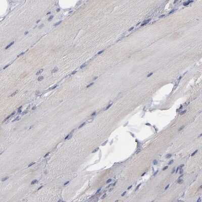 Immunohistochemistry-Paraffin: MIPOL1 Antibody [NBP1-86161]