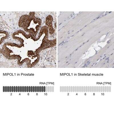 Immunohistochemistry-Paraffin: MIPOL1 Antibody [NBP1-86161]