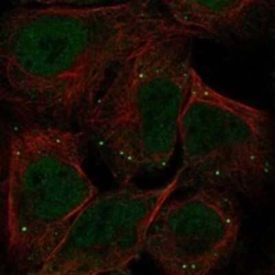 Immunocytochemistry/ Immunofluorescence: MIR16 Antibody [NBP3-17273]
