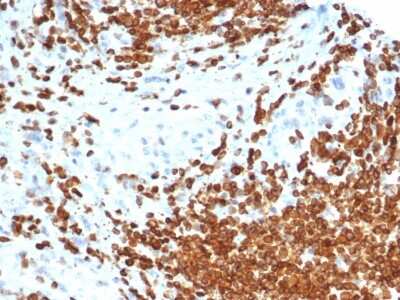 Immunohistochemistry-Paraffin: MIS/AMH Antibody (AMH/6713R) [NBP3-07296]
