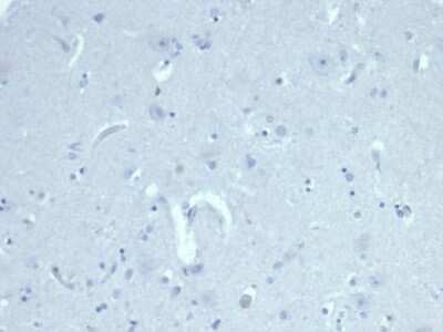 Immunohistochemistry-Paraffin: MIS/AMH Antibody (AMH/6713R) [NBP3-07296]