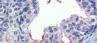 Immunohistochemistry: MIS/AMH Antibody [NBP1-70639]