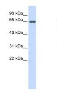 Western Blot: MIS/AMH Antibody [NBP1-70639]