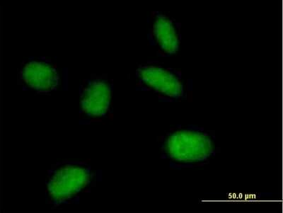 Immunocytochemistry/ Immunofluorescence: MIS12 Antibody [H00079003-B02P]
