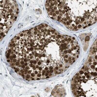 Immunohistochemistry-Paraffin: MIS18A Antibody [NBP1-88943]