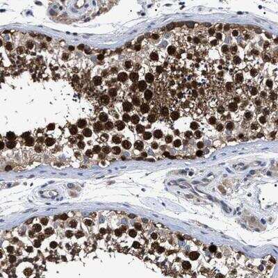 Immunohistochemistry-Paraffin: MIS18A Antibody [NBP1-88944]