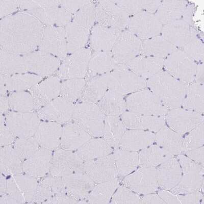 Immunohistochemistry-Paraffin: MIST1 Antibody [NBP2-30979]