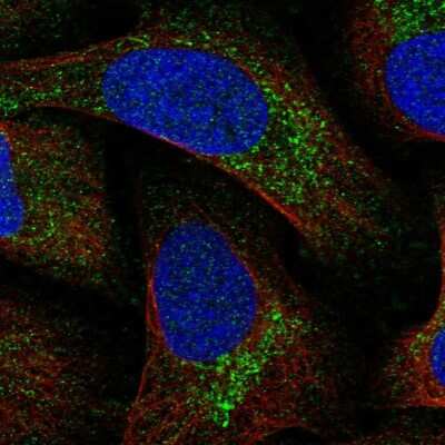 Immunocytochemistry/ Immunofluorescence: MITD1 Antibody [NBP1-82828]