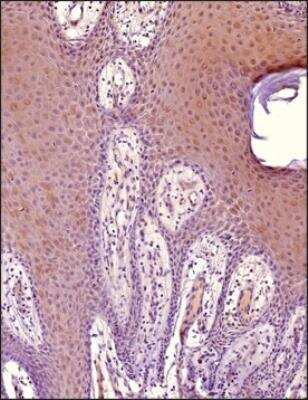 Immunohistochemistry-Paraffin: MITF Antibody (21D1418) - Azide Free [NBP2-33229]