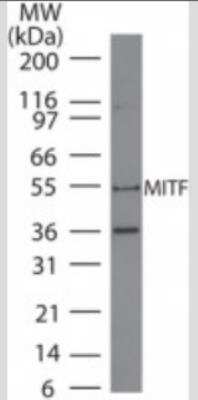 Western Blot: MITF Antibody (21D1418)Azide Free [NBP2-33229]