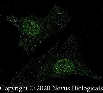 Immunocytochemistry/ Immunofluorescence: MITF Antibody (21D1418) - BSA Free [NB100-56561]