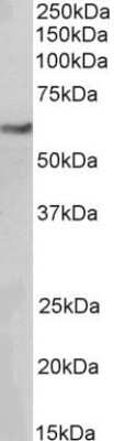 Western Blot: MITF Antibody (21D1418)BSA Free [NB100-56561]