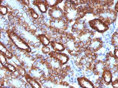 Immunohistochemistry-Paraffin: MITF Antibody (C5/D5) - IHC-Prediluted [NBP2-48263]