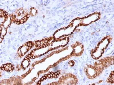 Immunohistochemistry-Paraffin: MITF Antibody (C5/D5) - IHC-Prediluted [NBP2-48263]