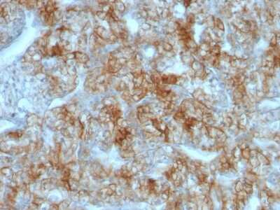 Immunohistochemistry-Paraffin: MITF Antibody (C5/D5) - IHC-Prediluted [NBP2-48263]