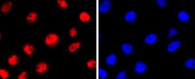Immunocytochemistry/ Immunofluorescence: MITF Antibody (JF100-01) [NBP2-66951]