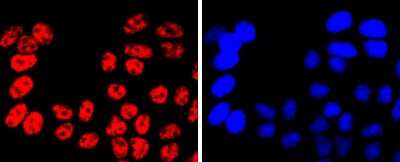 Immunocytochemistry/ Immunofluorescence: MITF Antibody (JF100-01) [NBP2-66951]